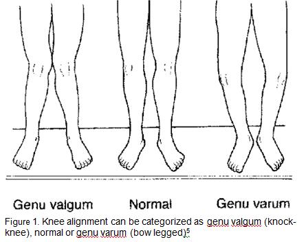 exercises for knock knees pdf